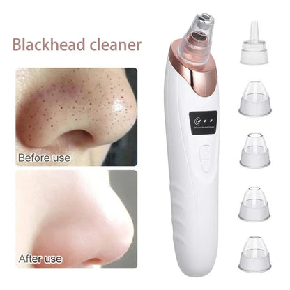 Blackheads, Whiteheads & Face Pores Cleaner & Suction Machine